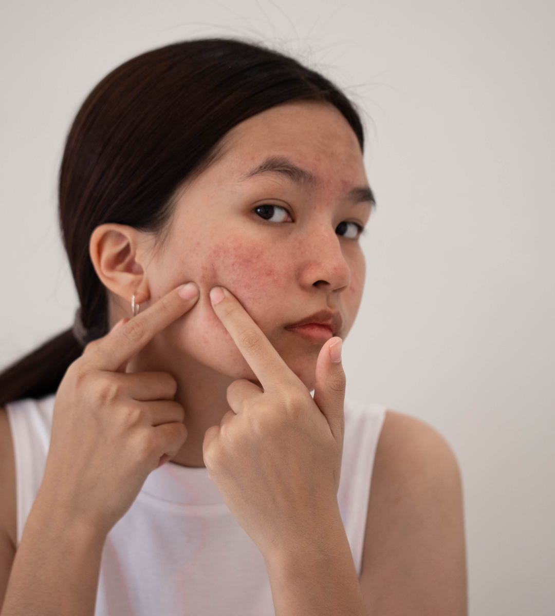 femmes avec boutons sur le visage