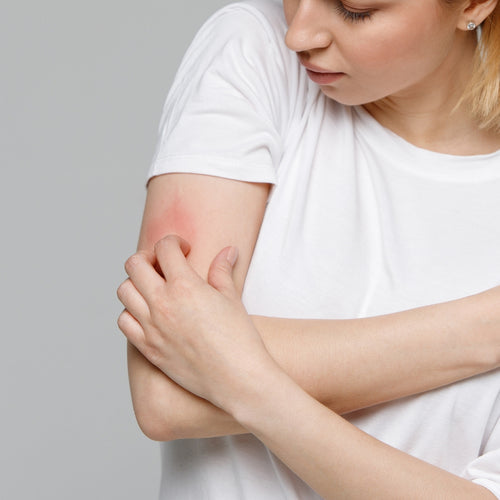 femme avec peau seche